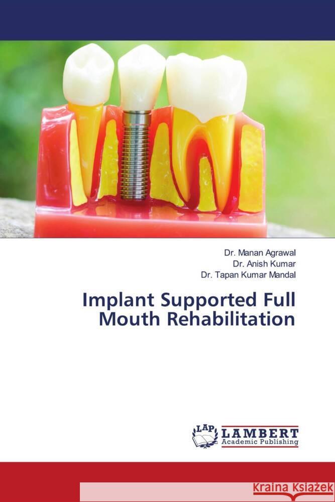 Implant Supported Full Mouth Rehabilitation Agrawal, Dr. Manan, Kumar, Dr. Anish, Mandal, Dr. Tapan Kumar 9786204184890 LAP Lambert Academic Publishing - książka