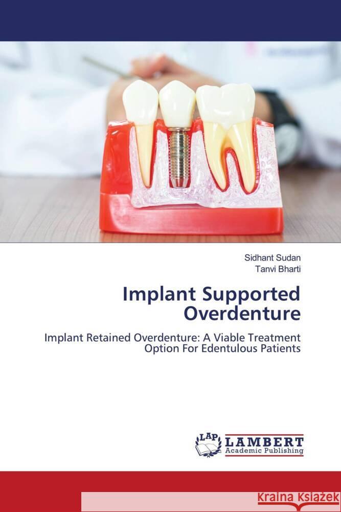 Implant Supported Overdenture Sudan, Sidhant, Bharti, Tanvi 9786205487983 LAP Lambert Academic Publishing - książka