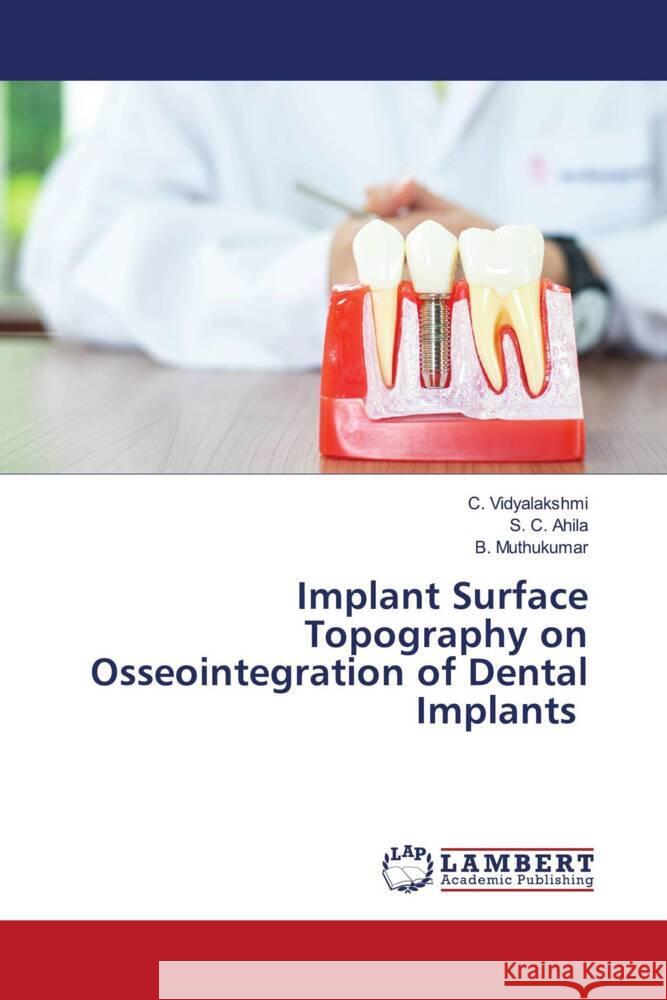 Implant Surface Topography on Osseointegration of Dental Implants C. Vidyalakshmi S. C. Ahila B. Muthukumar 9786208424145 LAP Lambert Academic Publishing - książka