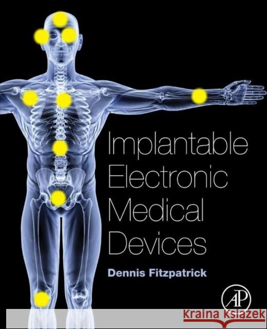Implantable Electronic Medical Devices Fitzpatrick, Dennis   9780124165564 Elsevier Science - książka