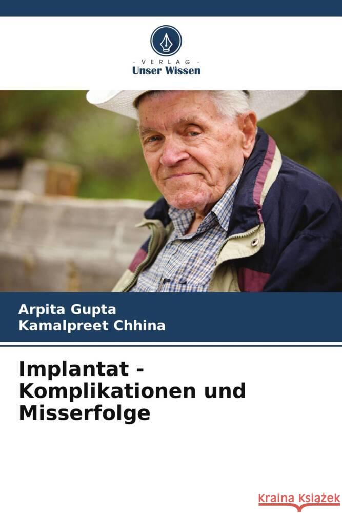 Implantat - Komplikationen und Misserfolge Arpita Gupta Kamalpreet Chhina 9786208073237 Verlag Unser Wissen - książka