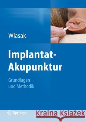 Implantat-Akupunktur: Grundlagen Und Methodik Wlasak, Rolf 9783642200250 Springer - książka