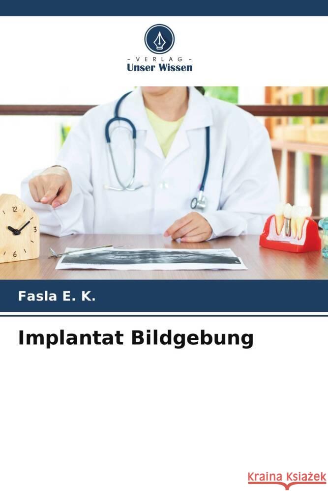 Implantat Bildgebung E. K., Fasla 9786204706986 Verlag Unser Wissen - książka