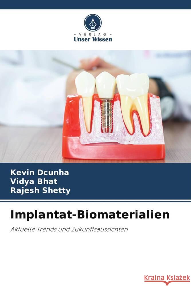 Implantat-Biomaterialien Dcunha, Kevin, Bhat, Vidya, Shetty, Rajesh 9786208198060 Verlag Unser Wissen - książka