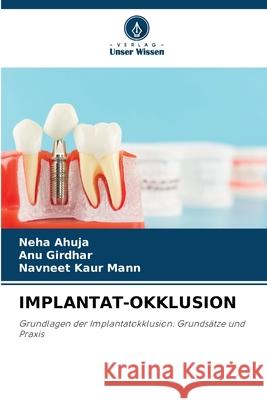 IMPLANTAT-OKKLUSION Ahuja, Neha, Girdhar, ANU, Kaur Mann, Navneet 9786208715700 Verlag Unser Wissen - książka