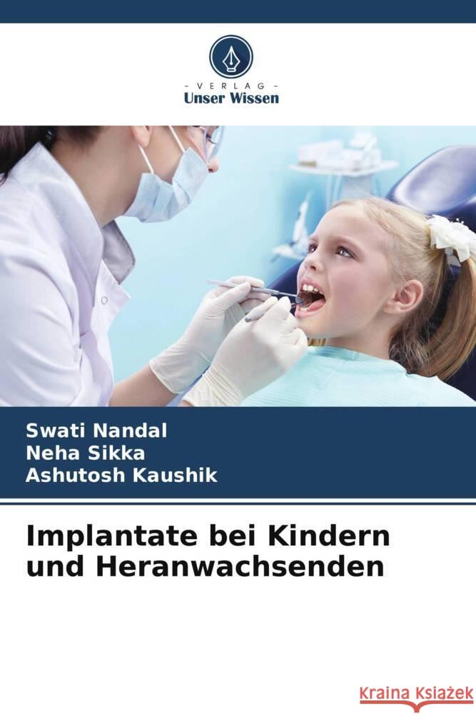 Implantate bei Kindern und Heranwachsenden Nandal, Swati, Sikka, Neha, Kaushik, Ashutosh 9786208250645 Verlag Unser Wissen - książka