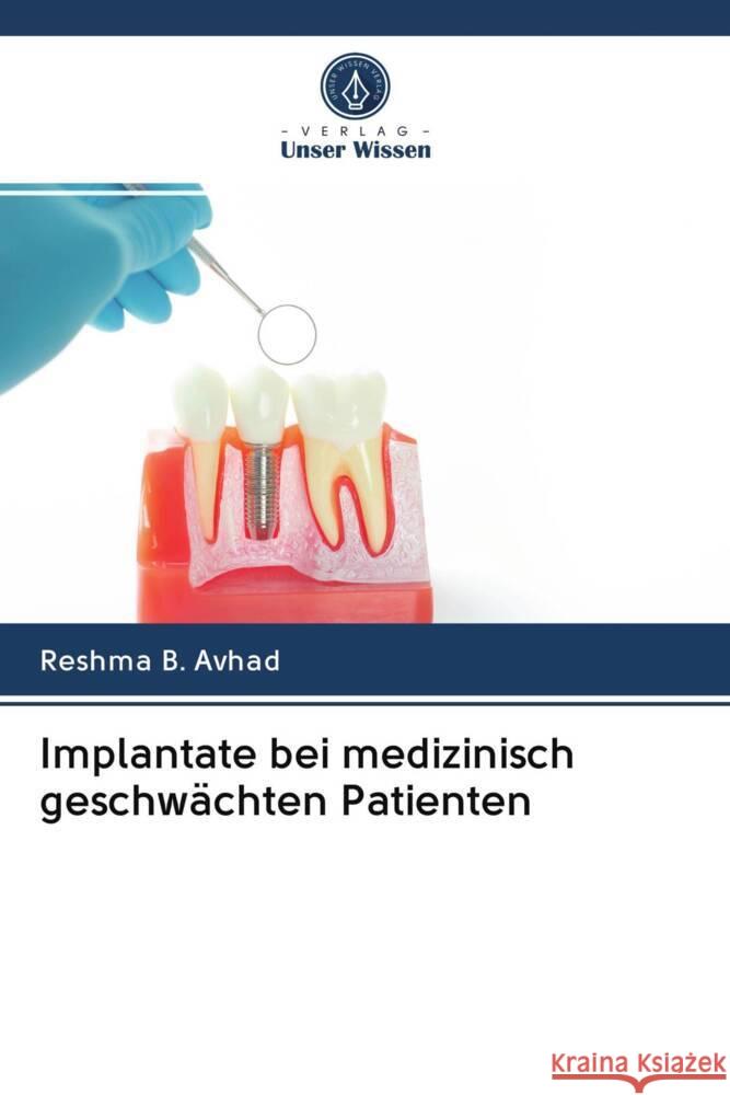 Implantate bei medizinisch geschwächten Patienten Avhad, Reshma B. 9786202963237 Verlag Unser Wissen - książka