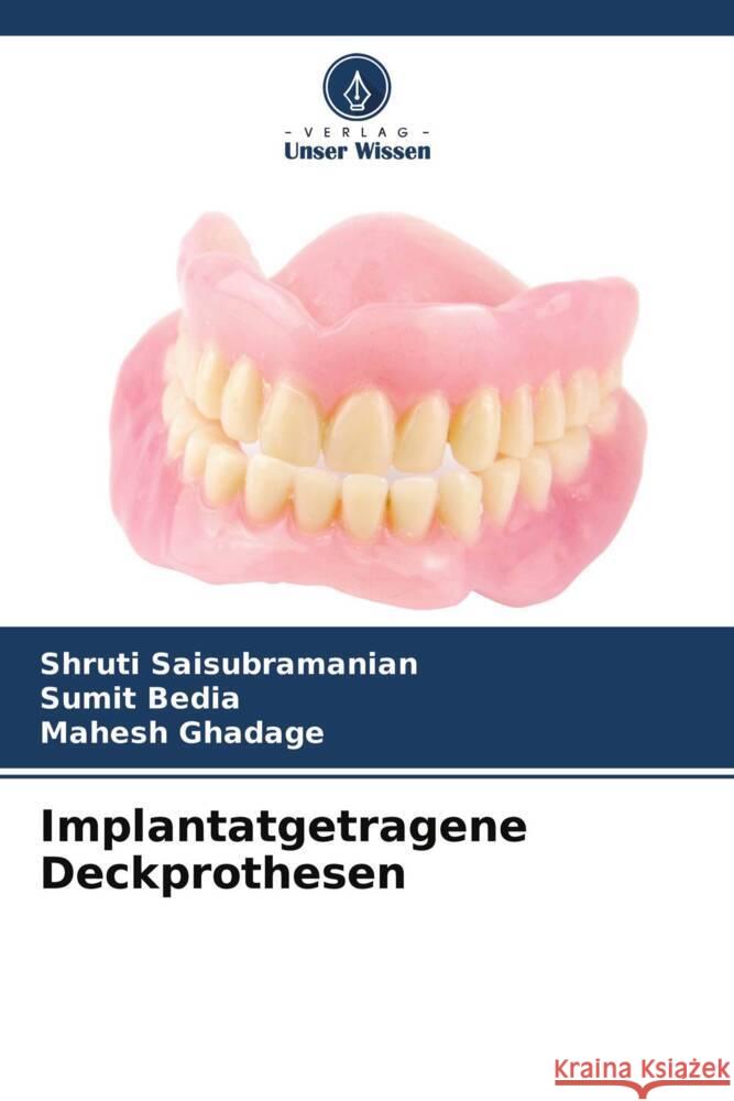Implantatgetragene Deckprothesen Saisubramanian, Shruti, Bedia, Sumit, Ghadage, Mahesh 9786204648187 Verlag Unser Wissen - książka