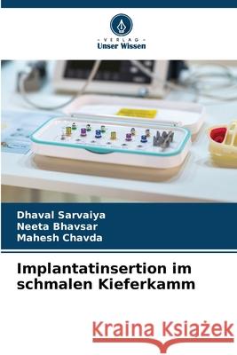 Implantatinsertion im schmalen Kieferkamm Sarvaiya, Dhaval, Bhavsar, Neeta, Chavda, Mahesh 9786200695253 Verlag Unser Wissen - książka