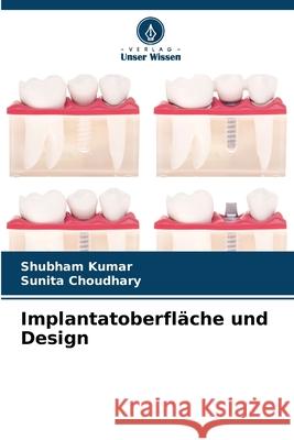 Implantatoberfl?che und Design Shubham Kumar Sunita Choudhary 9786207906871 Verlag Unser Wissen - książka