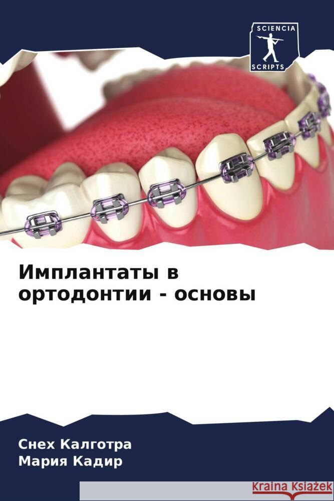 Implantaty w ortodontii - osnowy Kalgotra, Sneh, Kadir, Mariq 9786208131142 Sciencia Scripts - książka