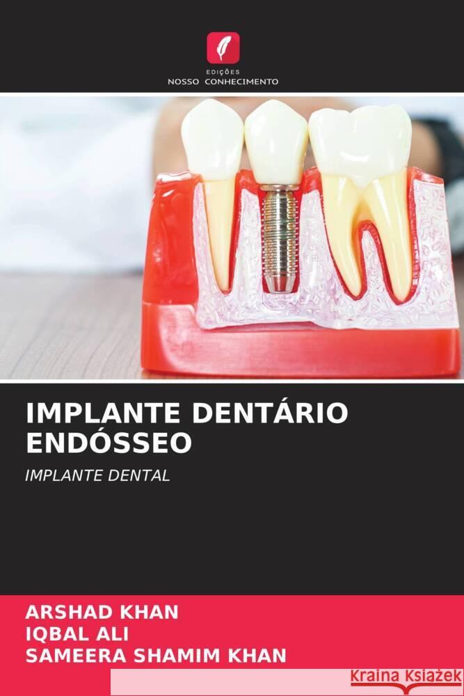 IMPLANTE DENTÁRIO ENDÓSSEO Khan, Arshad, Ali, Iqbal, Khan, Sameera Shamim 9786205435526 Edições Nosso Conhecimento - książka