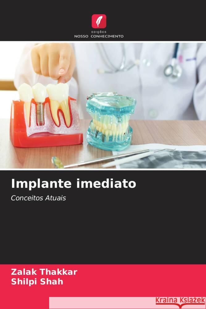 Implante imediato Zalak Thakkar Shilpi Shah 9786206987987 Edicoes Nosso Conhecimento - książka