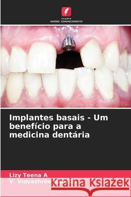 Implantes basais - Um benefício para a medicina dentária A, Lizy Teena, Nandini, V. Vidyashree 9786206834717 Edições Nosso Conhecimento - książka