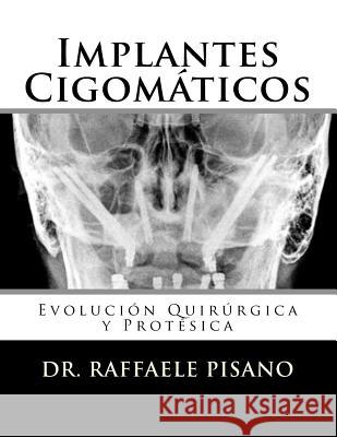 Implantes Cigomáticos: Evolución Quirúrgica y Protésica Pisano, Raffaele 9781983850165 Createspace Independent Publishing Platform - książka