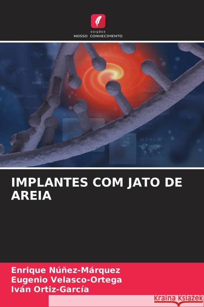 IMPLANTES COM JATO DE AREIA Núñez-Márquez, Enrique, Velasco-Ortega, Eugenio, Ortiz-García, Iván 9786204887852 Edições Nosso Conhecimento - książka