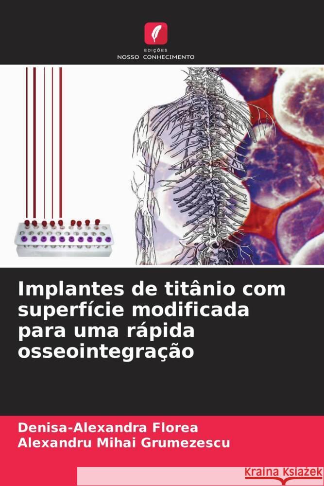 Implantes de titânio com superfície modificada para uma rápida osseointegração Florea, Denisa-Alexandra, Grumezescu, Alexandru Mihai 9786208640156 Edições Nosso Conhecimento - książka