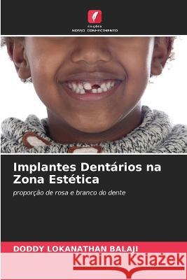 Implantes Dentarios na Zona Estetica Doddy Lokanathan Balaji   9786205653890 Edicoes Nosso Conhecimento - książka