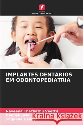 IMPLANTES DENTÁRIOS EM ODONTOPEDIATRIA Thazhathu Veettil, Naveena, Jose, Deepak, George, Sageena 9786208649746 Edições Nosso Conhecimento - książka