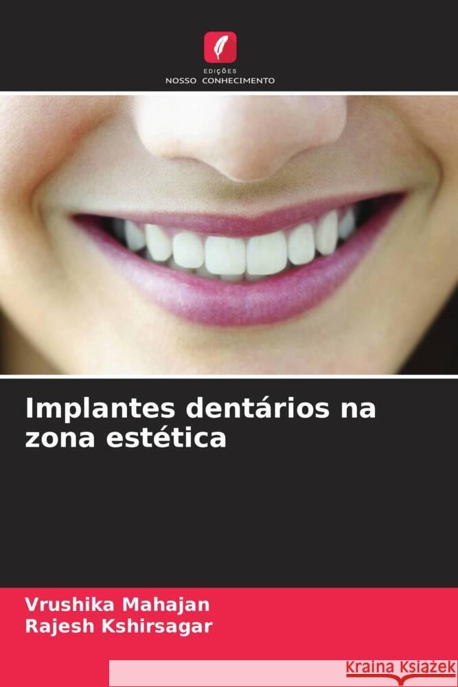 Implantes dent?rios na zona est?tica Vrushika Mahajan Rajesh Kshirsagar 9786207259694 Edicoes Nosso Conhecimento - książka