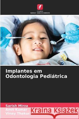 Implantes em Odontologia Pediatrica Sarish Mirza Amit Kumar Vinay Thakur 9786205811214 Edicoes Nosso Conhecimento - książka