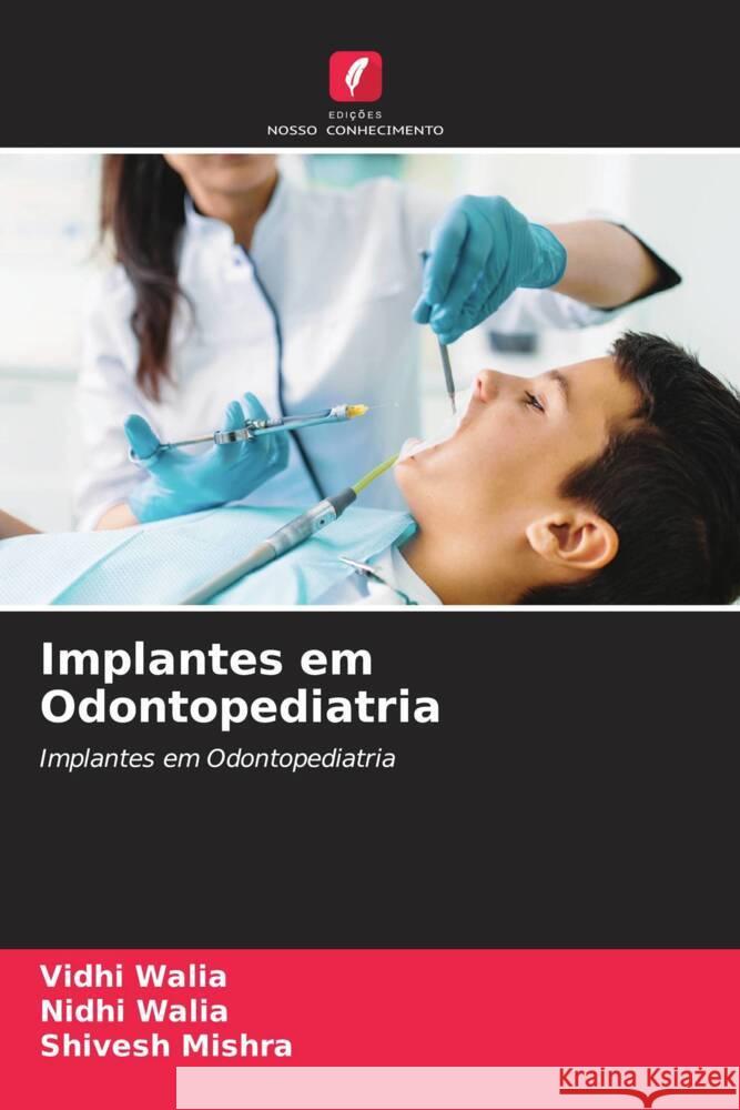 Implantes em Odontopediatria Walia, Vidhi, Walia, Nidhi, Mishra, Shivesh 9786208308568 Edições Nosso Conhecimento - książka
