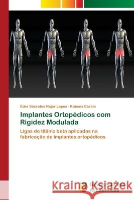 Implantes Ortopédicos com Rigidez Modulada Najar Lopes, Éder Sócrates 9786139677252 Novas Edicioes Academicas - książka