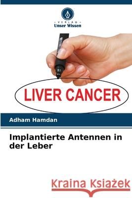 Implantierte Antennen in der Leber Hamdan, Adham 9786136362915 Verlag Unser Wissen - książka