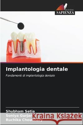 Implantologia dentale Shubham Setia Soniya Gurjar Ruchika Choudhary 9786206104049 Edizioni Sapienza - książka