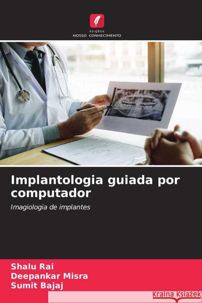 Implantologia guiada por computador Shalu Rai Deepankar Misra Sumit Bajaj 9786206674894 Edicoes Nosso Conhecimento - książka