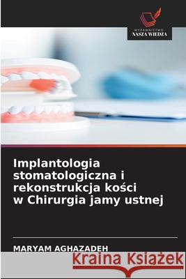 Implantologia stomatologiczna i rekonstrukcja kosci w Chirurgia jamy ustnej Aghazadeh, Maryam 9786208909871 Wydawnictwo Nasza Wiedza - książka
