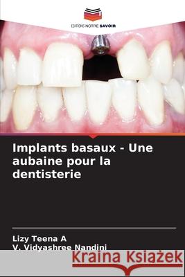 Implants basaux - Une aubaine pour la dentisterie A, Lizy Teena, Nandini, V. Vidyashree 9786206834687 Editions Notre Savoir - książka