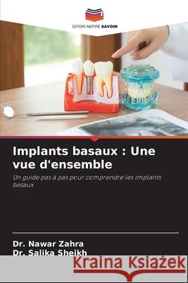 Implants basaux : Une vue d'ensemble Zahra, Dr. Nawar, Sheikh, Dr. Salika 9786208481216 Editions Notre Savoir - książka
