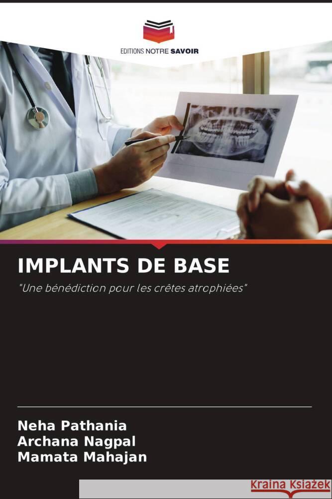 IMPLANTS DE BASE Pathania, Neha, Nagpal, Archana, Mahajan, Mamata 9786204417349 Editions Notre Savoir - książka