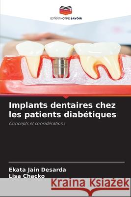Implants dentaires chez les patients diabétiques Jain Desarda, Ekata, Chacko, Lisa 9786202363822 Editions Notre Savoir - książka