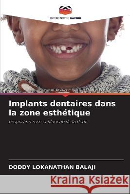 Implants dentaires dans la zone esth?tique Doddy Lokanathan Balaji 9786205653814 Editions Notre Savoir - książka