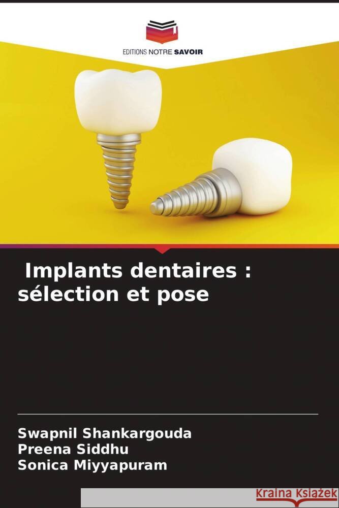 Implants dentaires : sélection et pose Shankargouda, Swapnil, Siddhu, Preena, Miyyapuram, Sonica 9786204995557 Editions Notre Savoir - książka