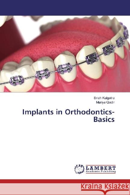 Implants in Orthodontics- Basics Kalgotra, Sneh; Qadir, Mariya 9786202093156 LAP Lambert Academic Publishing - książka