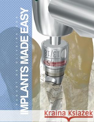 Implants Made Easy August D 9780557304325 Lulu Press - książka