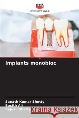 Implants monobloc Shetty, Sanath Kumar, Ali, Basith, Shetty, Rajesh 9786203890099 Editions Notre Savoir - książka