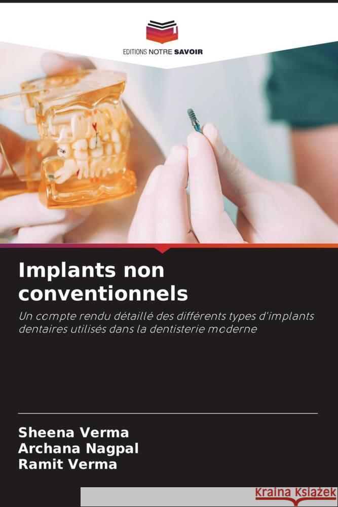 Implants non conventionnels Verma, Sheena, Nagpal, Archana, verma, Ramit 9786205557792 Editions Notre Savoir - książka