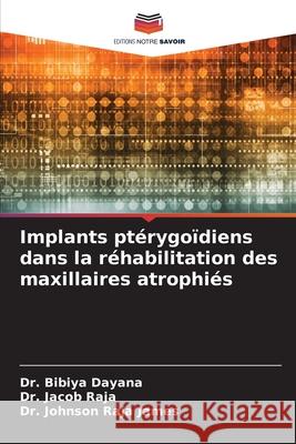 Implants ptérygoïdiens dans la réhabilitation des maxillaires atrophiés Dayana, Dr. Bibiya, Raja, Dr. Jacob, Raja James, Dr. Johnson 9786209107269 Editions Notre Savoir - książka