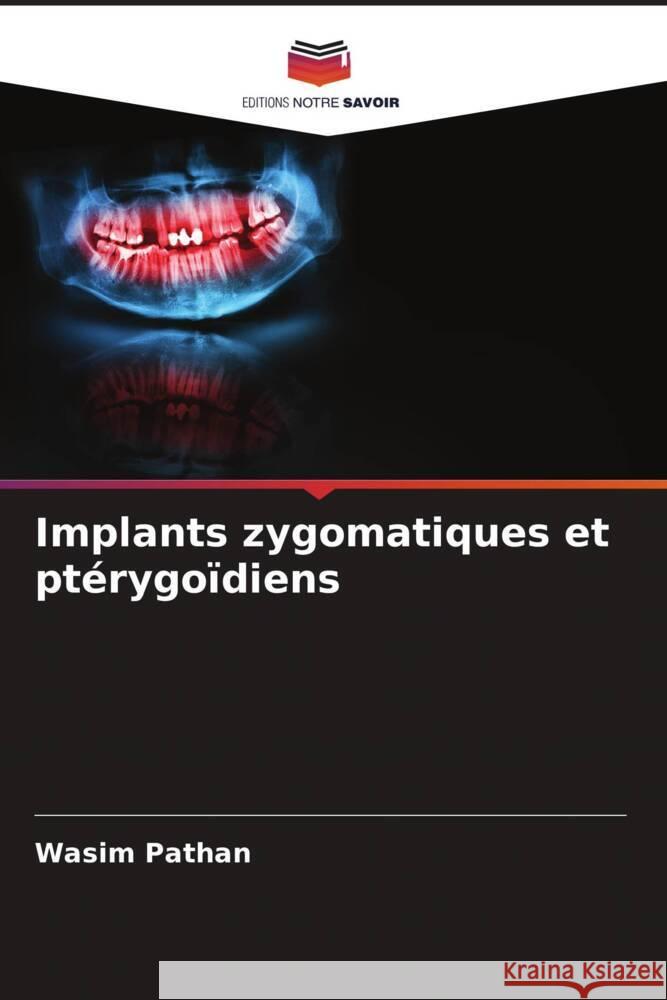 Implants zygomatiques et ptérygoïdiens Pathan, Wasim 9786205164822 Editions Notre Savoir - książka