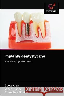 Implanty dentystyczne Geeta Arya, Varun Kumar, Shambhavi Shukla 9786202855488 Wydawnictwo Nasza Wiedza - książka