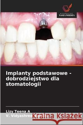 Implanty podstawowe - dobrodziejstwo dla stomatologii A, Lizy Teena, Nandini, V. Vidyashree 9786206834700 Wydawnictwo Nasza Wiedza - książka