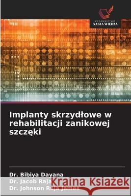 Implanty skrzydlowe w rehabilitacji zanikowej szczeki Dayana, Dr. Bibiya, Raja, Dr. Jacob, Raja James, Dr. Johnson 9786209081668 Wydawnictwo Nasza Wiedza - książka