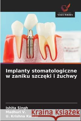 Implanty stomatologiczne w zaniku szczeki i zuchwy Singh, Ishita, V., Madhuri, Kumar, U. Krishna 9786203919394 Wydawnictwo Nasza Wiedza - książka