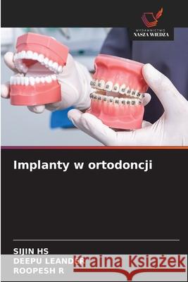 Implanty w ortodoncji HS, SIJIN, LEANDER, DEEPU, R, ROOPESH 9786208758462 Wydawnictwo Nasza Wiedza - książka