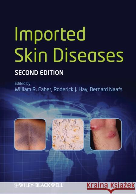 Imported Skin Diseases William R Faber 9780470672266  - książka