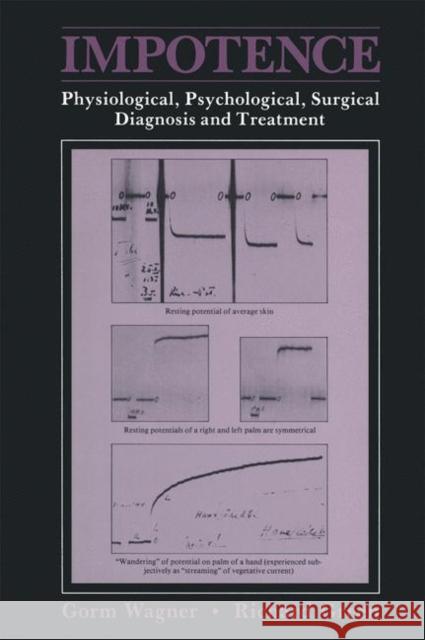 Impotence: Physiological, Psychological, Surgical Diagnosis and Treatment Gorm Wagner 9781468410976 Springer - książka